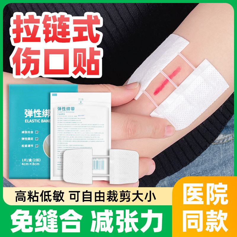 医用减张贴伤口免缝合针皮肤减张器剖腹产张力拉链式创口贴创可贴