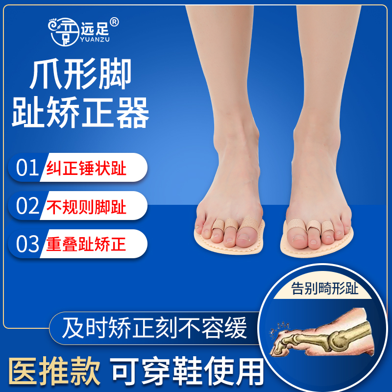 Hiking paw toe correction toe overlap finger toe mat pound pound finger correction of orthopedic mat toe bending correction
