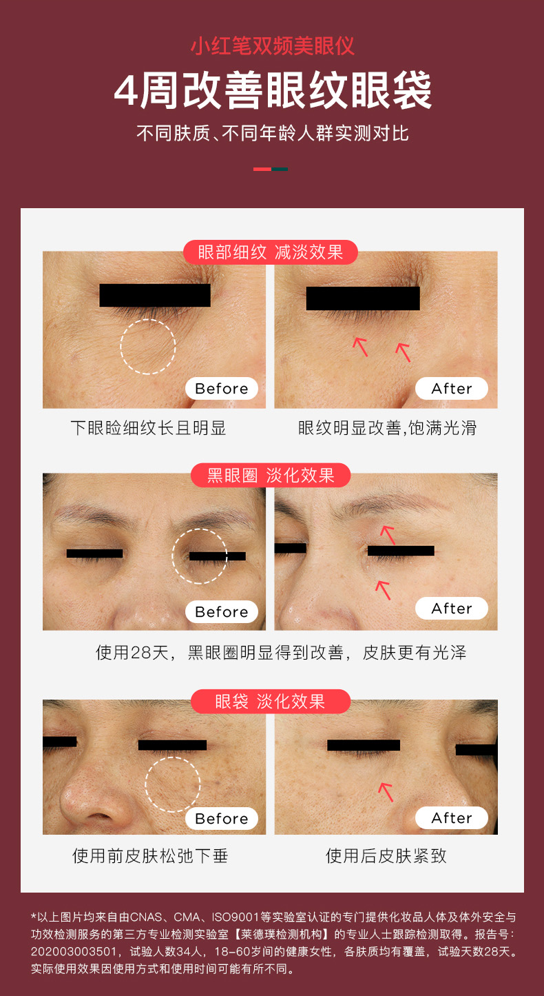 以色列 Soulink 小红笔 眼部美容按摩仪 图11