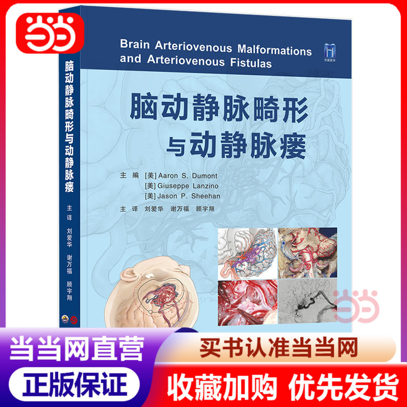 Cerebral Arteriovenous Malformations and Arteriovenous Fistulas