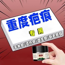 (Hong Kong Pharmacy) Traceless repair lightening scars pigmentation cleansing cream burns bumps acne pits and marks