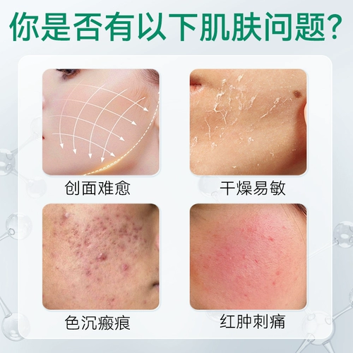 Эссенция, коллаген, послеоперационный восстанавливающий восстанавливающий лосьон для чувствительной кожи