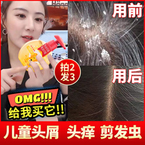 Childrens shampoo for children girls over the age of 3-6 12 years old and older children anti-itching no silicone oil official