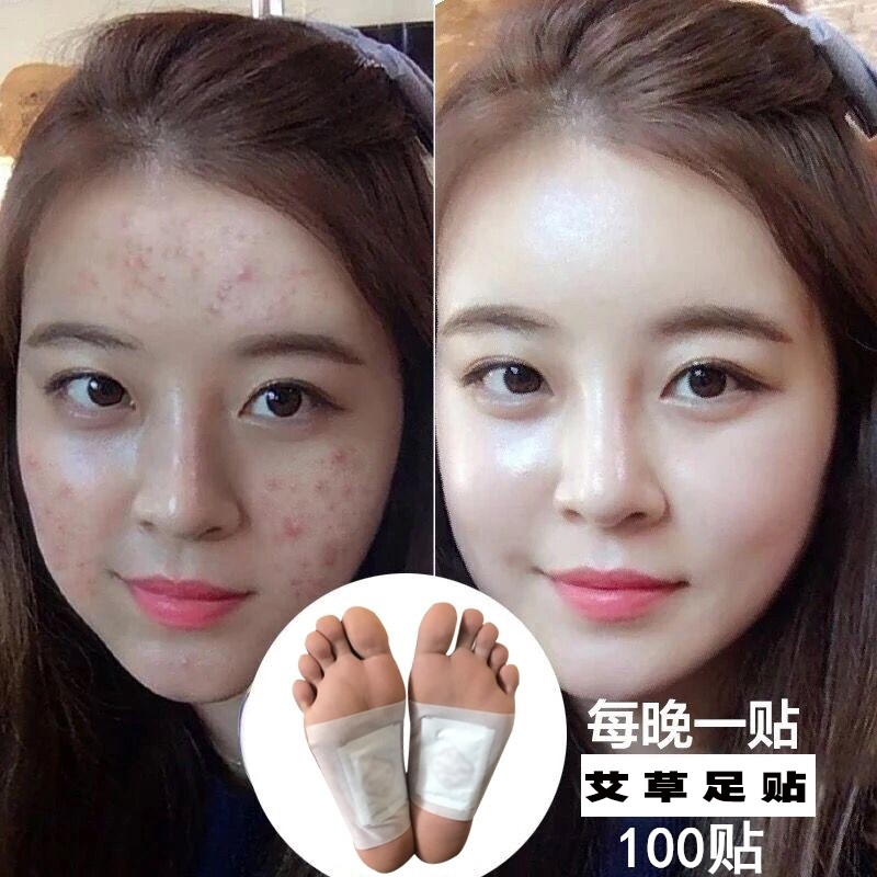 100 Old Beijing foot sticking to sleep to damp feet with female mosaicai leaves ginger foot ginger foot sticking to plantar and removing wet patch