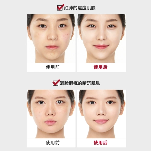 Medicube, тональный крем, консилер, скрывает прыщи, второе поколение