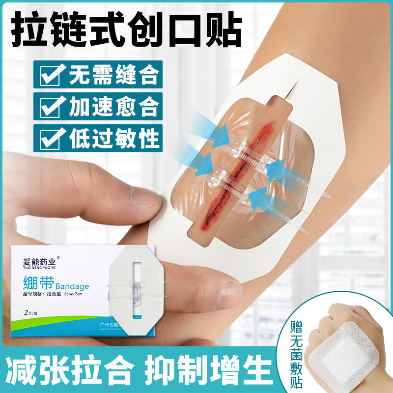 减张贴皮肤减张器儿童疤痕剖腹产伤口拉合免针缝合器拉链式创口贴