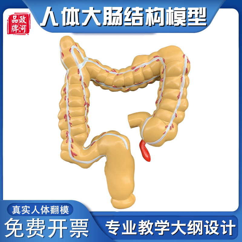 人体结肠病变模型 肛肠科消化内科大肠模型 医学人体器官解剖模具