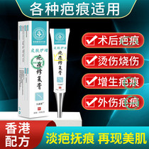 (New and old scars) Surgery to remove bumpy scars fall injuries repair hyperplasia acne pits acne marks and fade melanin burn cream