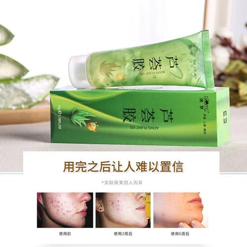 Увлажняющий осветляющий гель алоэ вера с женьшенем, анти-акне, скрывает прыщи, осветляет кожу