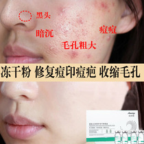 Oligopeptide freeze-dried powder acne acne pit cavity repair men and women shrink pores flagship store official website to buy