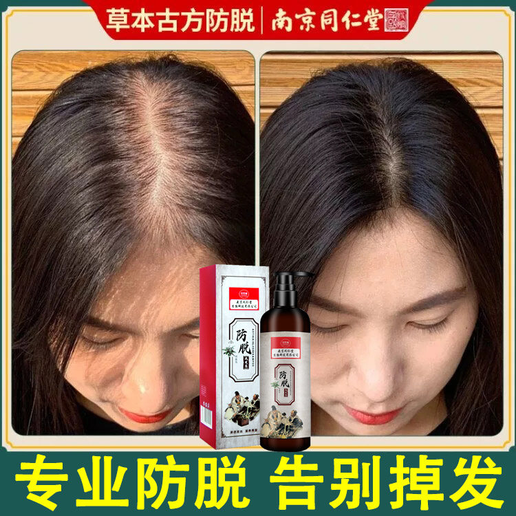 Tongrentang Ginger Anti-Hair Shampoo for hair loss Serious Male Private hair loss Hair Loss occurs Gendew