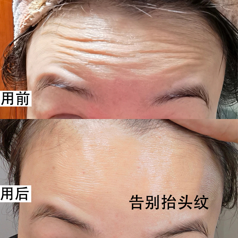 (Good Thing Recommended) Anti-creasing line with goodbye to the head tattoo Watered down fine tattoo back ten-year-old buy two and send one