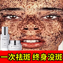 Freckle cream whitening and light spots pigment removal chloasma freckles liquid artifact