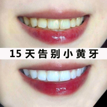 (Wei Ya recommended) clean teeth Mousse smoke stains tea teeth yellow white artifact beauty buy 2 get 1