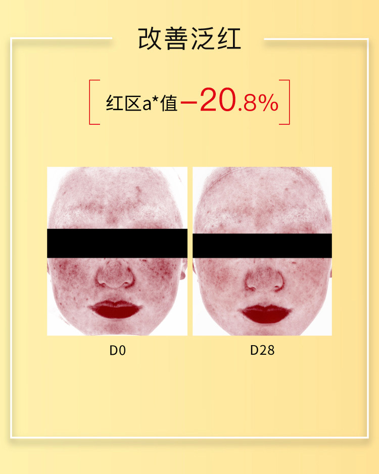 【香港直邮】 John Jeff 姜黄精华液30ml 敏皮专研抗氧|4%姜黄素+2%油橄榄 |褪红提亮双效 |控油不拔干 |熬夜暗沉救星