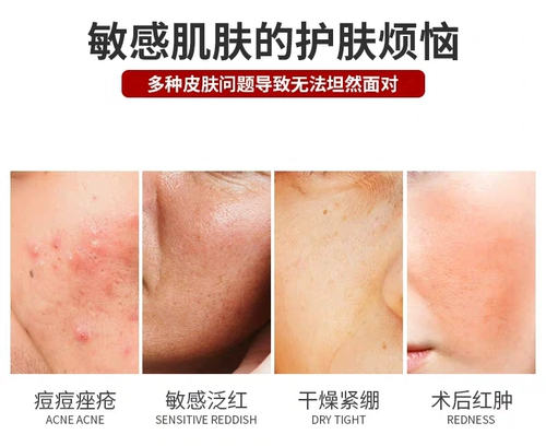 Маска для лица для чувствительной кожи, восстанавливающий увлажняющий холодный компресс, анти-акне