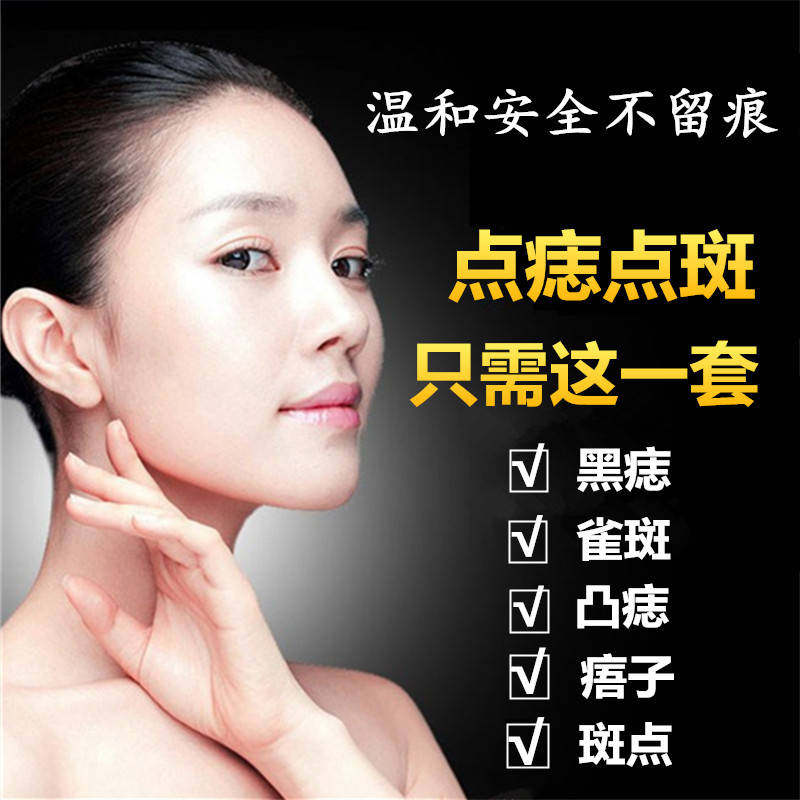 Go to mole points Mole Drops of Mole Black Mole Nevus mole Facial Spot Water Dispel Mole of Mole Paste Freckles deity Pen Dispel of Spotted Products