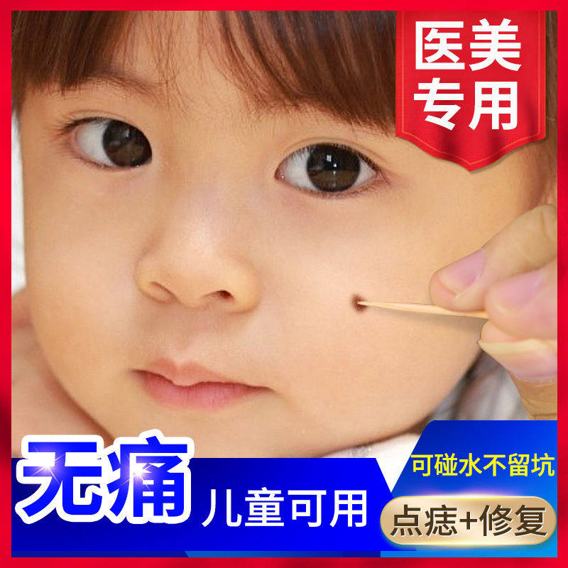 Point mole to mole the mole potion point mole paste No marks to remove the mole spot Spotted Water Freckle Nevus Pen Removing the face of the product