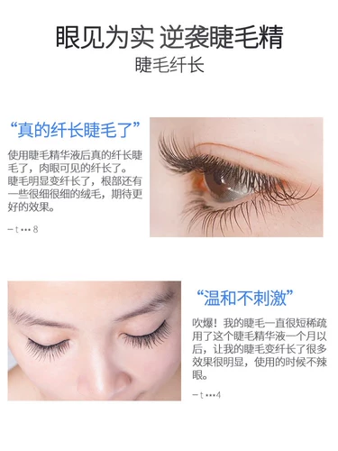 Увеличивающие накладные ресницы для роста волос, питательная плотная сыворотка для бровей, официальный продукт