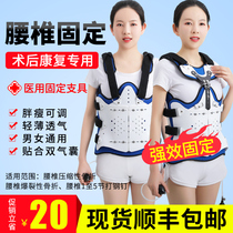 Thoracolumbar spine fixed brace Compression fracture lumbar support Lumbar postoperative stent Spine thoracolumbar spine protector Spine rehabilitation