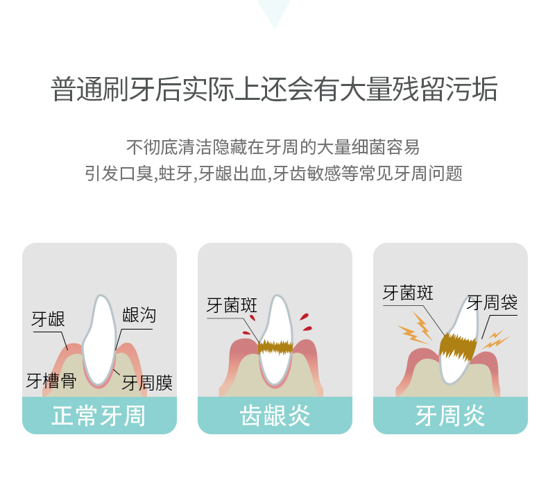 松下 MDJ1A 冲牙器 便携式牙缝水牙线 口腔清洁 图4
