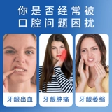 Пародонтит посвященный зубной пастой атрофия атрофия пероральная язва кровотечение, отек и боль, нереаризованное терапевтическое ослабление зубов