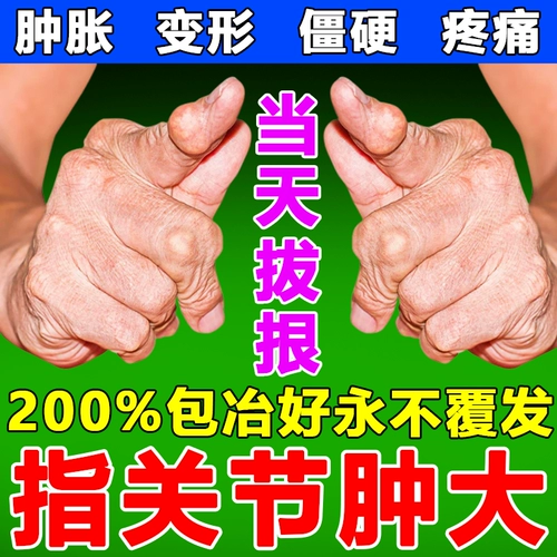 Деформация пальца деформация отек, густая боль, кислый артефакт препарата ревматоидный оболочка проверена кристаллы, подагра криптокристаллин