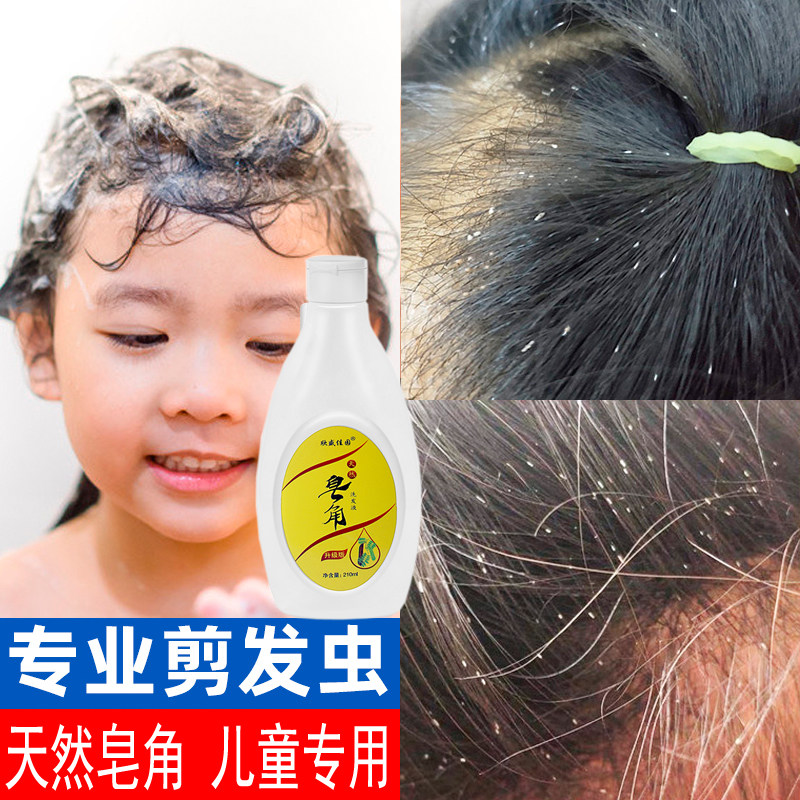 Children go to scraps to stop itchy shampoo girls special hair care soap corner liquid other than mite control oil to cut and hair-cut and shampoo