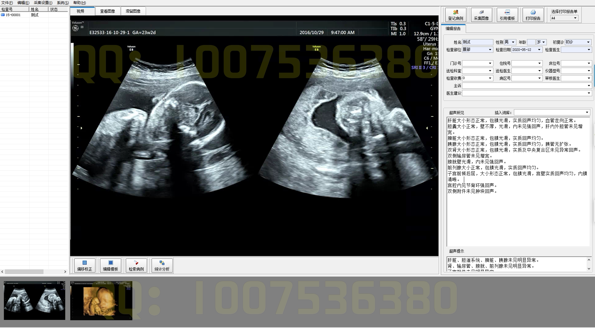 B Ultrasonic Ultrasonic Image Gastroenteroscopy Laparoscopy Outric Nose and Larynglass Brokoscopy Cysteoscopy Software