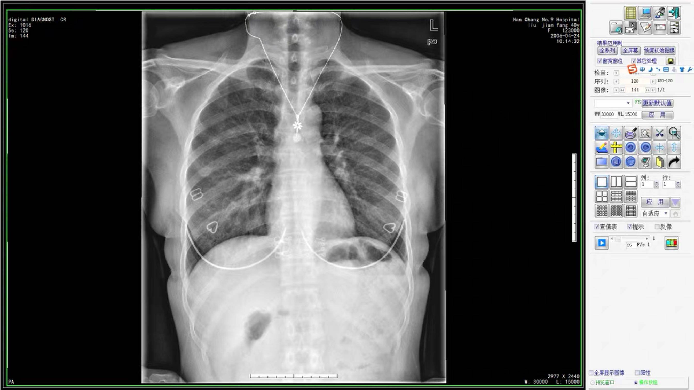 CT software CT workstation software X-ray machine software digital gastrointestinal DR software CR software NMR software Win10
