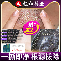 Renhe Pharmaceutical blackhead paste to suck strawberry nose oil official to acne shrink pore artifact flagship store