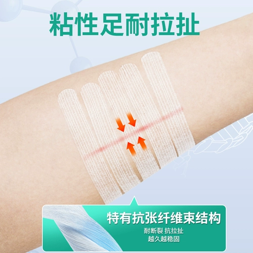 Медицинское снижение AOQI после профилактики инициализации и снижения гиперплазии рубца, помогающая расширить раны кесарева сечения