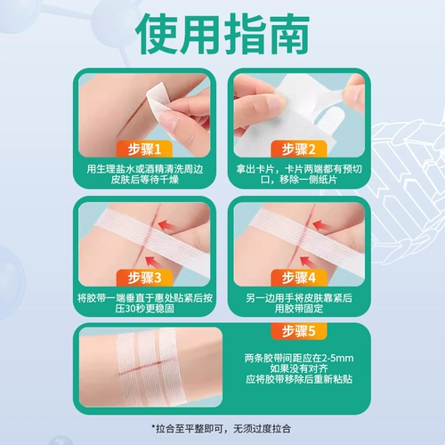 Медицинское снижение AOQI после профилактики инициализации и снижения гиперплазии рубца, помогающая расширить раны кесарева сечения