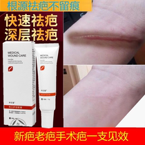 (Disscar cream) Scar Scar Scar Scalds Scalds Burn Double Eye Skin Scar Repair Care Caesarean Section Dedicated