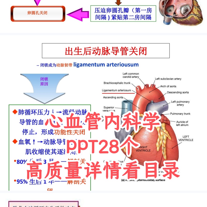 Cardiovascular Medicine, High Blood Pressure, Myocarditis, Coronary Angiography, Coronary Heart Disease Lecture Ppt Slides