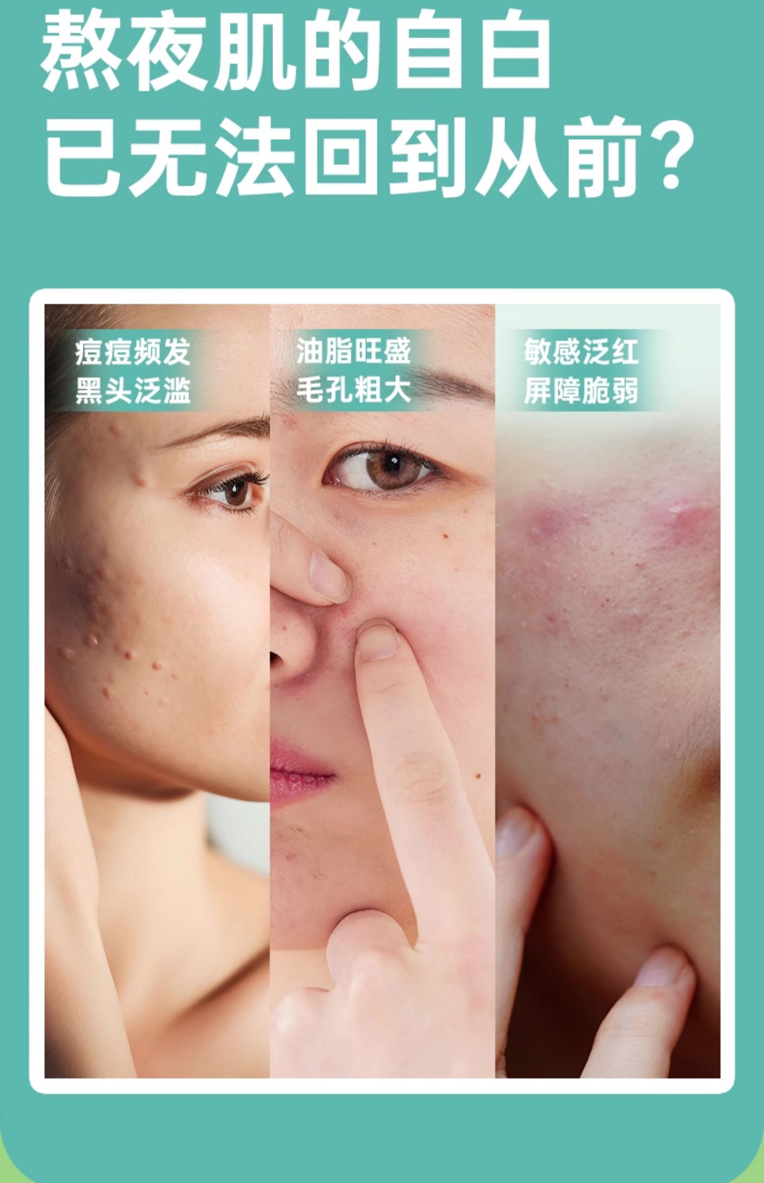 【香港直邮】 美国 OLLY 肌肤去瑕祛痘软糖50粒/瓶 含锌+维A+益生菌 莓果味 内服清透 素食无麸