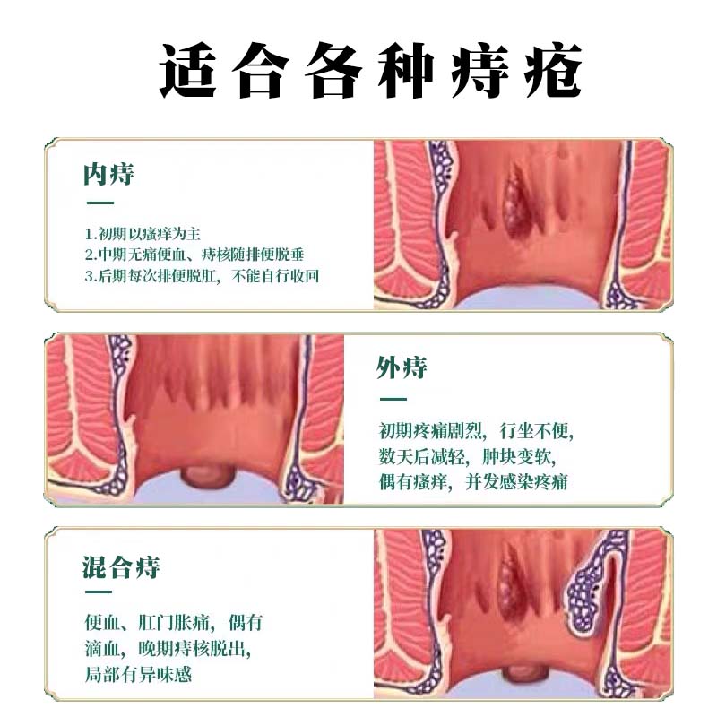 本草痔疮膏：告别痔疮烦恼，重获舒适生活！