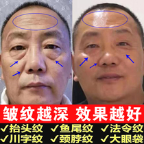 Botox freeze-dried tablets Youth freeze-dried milk essence essence Flagship store broken lines and frozen age cream water Ten