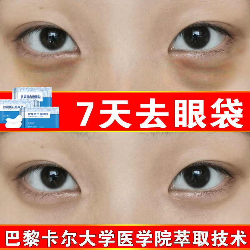 Collagen eye mask removes eye bags, fades dark circles, fine lines, removes eye bags, lifts, tightens, anti-wrinkle