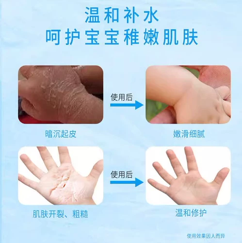 Крем для рук, демисезонный маленький милый портативный увлажняющий комплект, против трещин