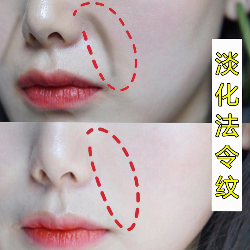 Fa Ling pattern stickers official flagship store bid farewell to the octagonal wrinkles mask patch fade small iron to eliminate artifact