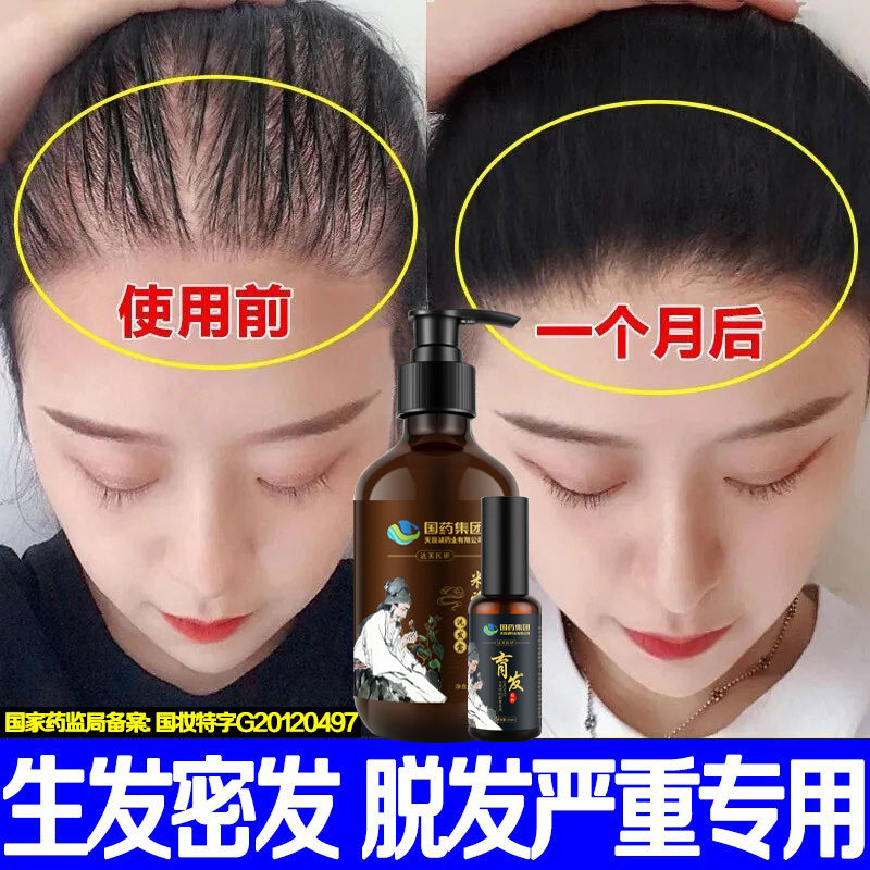 Anti-hair loss shampoo what is the official brand flagship store for men and women with severe hair loss dark hair loss