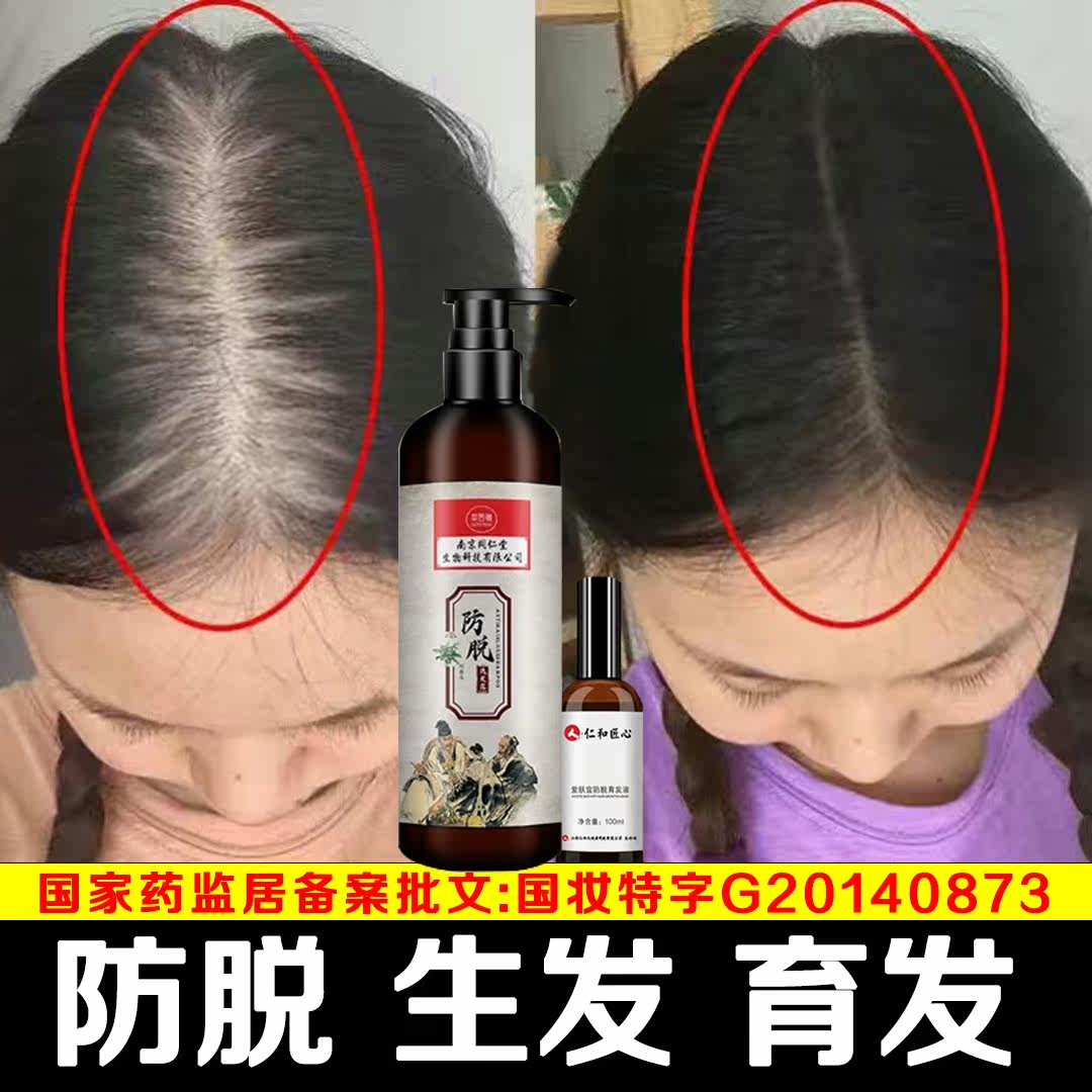 Hominin Tang Ginger Anti-Hair Shampoo water control Oil Cuttings Stop Itch Postpartum Postpartum Severe Growth Growth Hair God