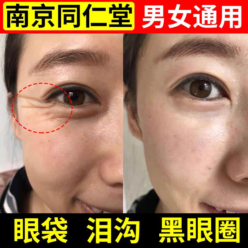Eye cream anti-wrinkle to fine-line eye bags to downplay fine dark circles Tight tight official flagship store men and women