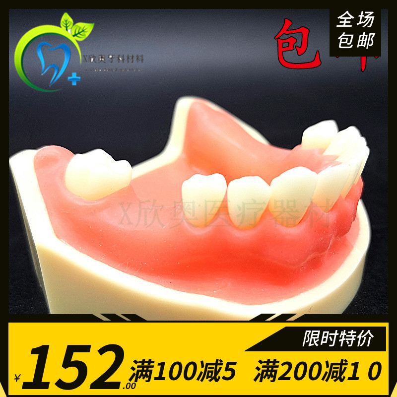 牙科口腔模型 教学模型 下颌种植练习模型 软银种植练习模型 包邮