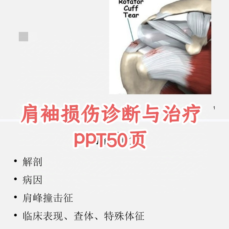 Diagnosis and Treatment of Rotator Cuff Injuries, Physical Examination, Imaging Diagnosis, Anatomy, Ppt Slide Courseware Diagnosis and Treatment of Rotator Cuff Injuries, Physical Examination, Imaging Diagnosis, Anatomy, Ppt Slide Courseware