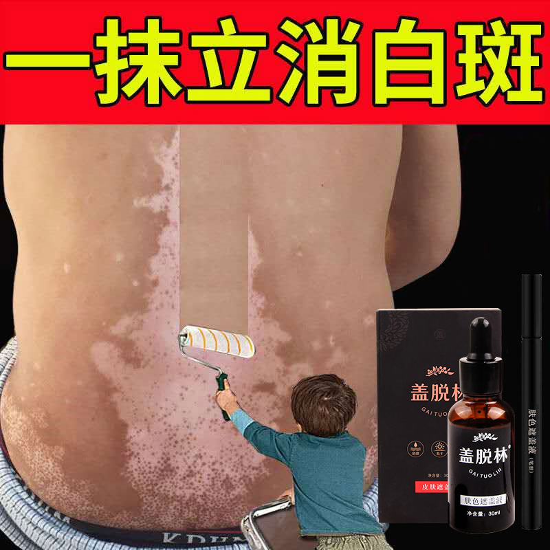 White spot covered liquid pen type face cover white purpura wind waterproof and anti-sweat persistent skin color covering liquid hand external-Taobao