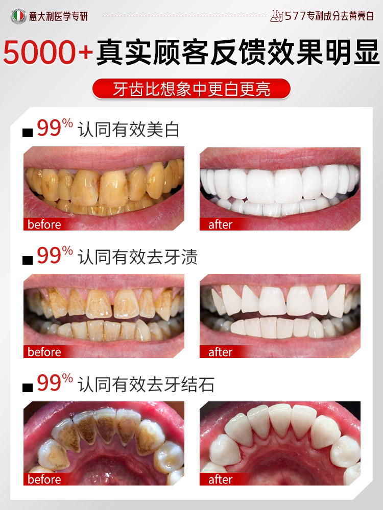 Toothpaste for Removing Yellow Stains, Bad Breath, Whitening, Quick Whitening Effect, Removes Odors, Freshens, Official, for Adults, for Women and Men Only