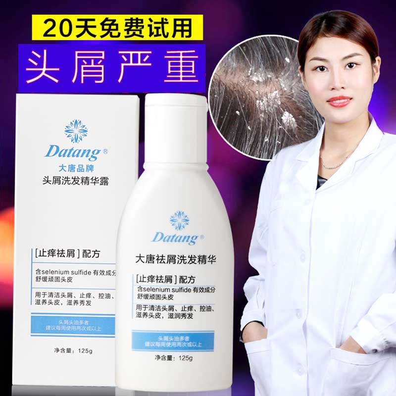 Datang shampoo to remove dandruff, itching, oil control, anti-fungal, anti-mite, male and female shampoo to remove large pieces of dandruff official