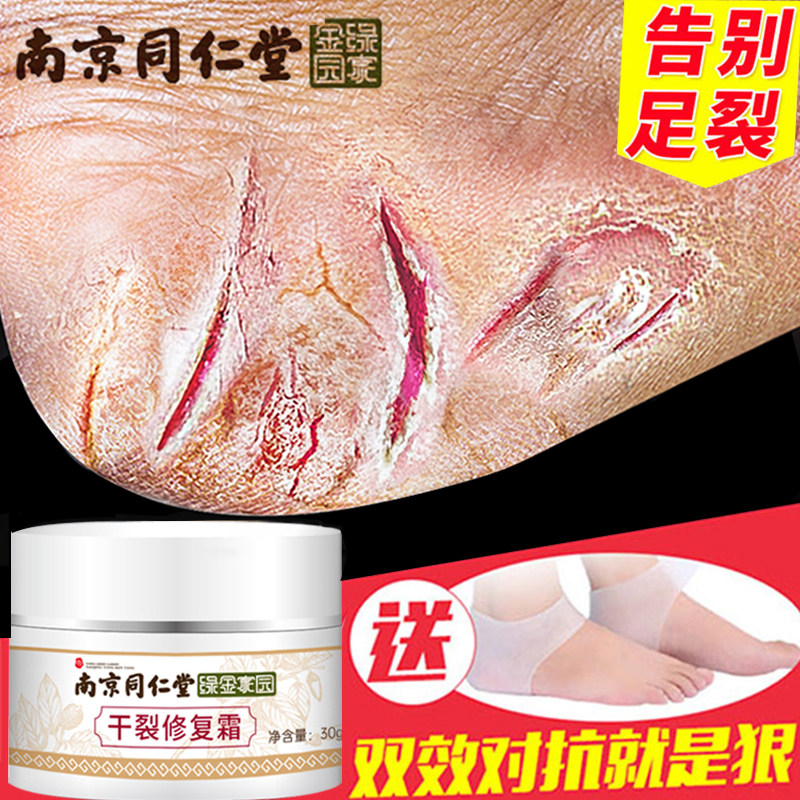 Heel dry crack repair cream crack anti-crack crack artifact hand foot crack cream horse oil sole foot crack crack healing